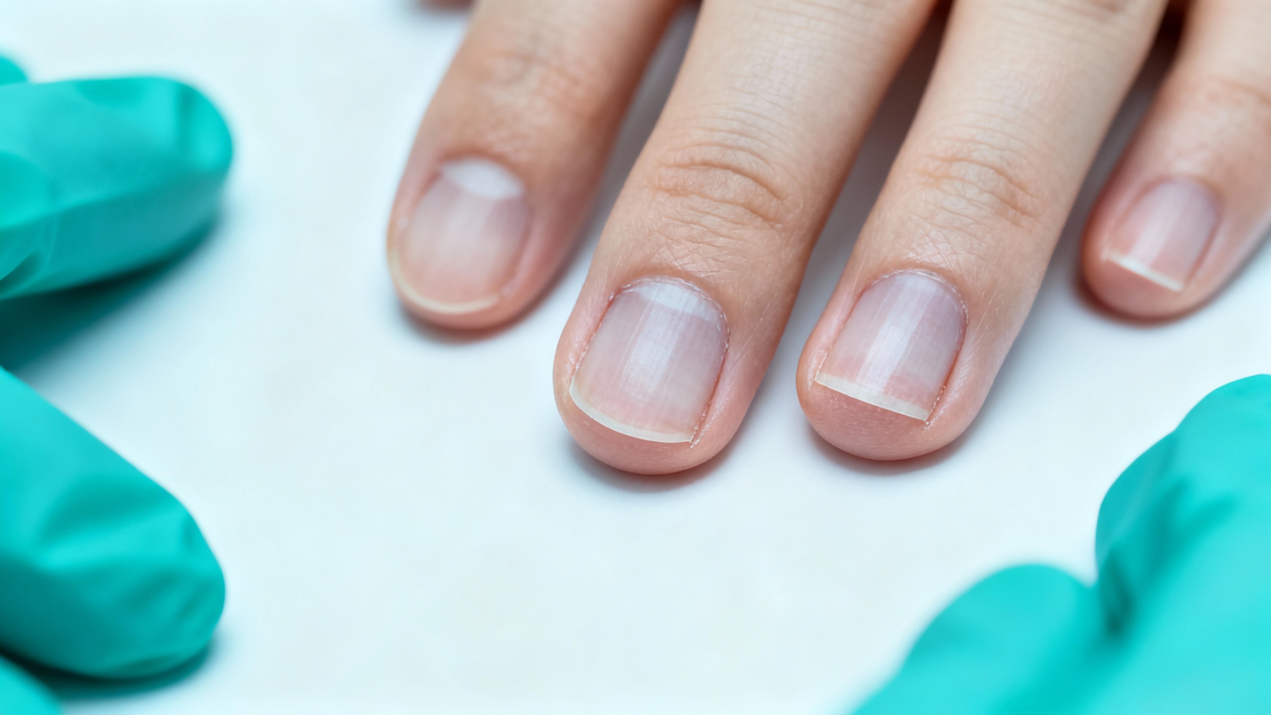 Understanding and Managing Nail Fungus